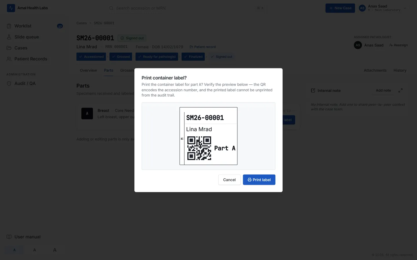 Specimen container label print dialog